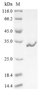 Tetanus toxin, partial, Clostridium tetani, recombinant