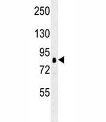 Anti-RSK1 / RPS6KA1, clone 205CT18.3.1