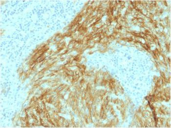 Anti-CD21 (Mature B-Cell &amp; Follicular Dendritic Cell Marker) Monoclonal Antibody (Clone: CR2/1952)
