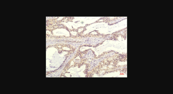 Anti-IL-8 (13F8), monoclonal