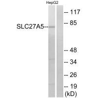 Anti-SLC27A5