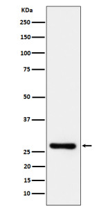Anti-TRAIL R3 / DcR1, clone 31T28