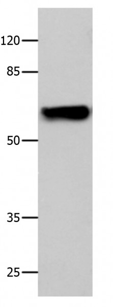 Anti-CNGA2
