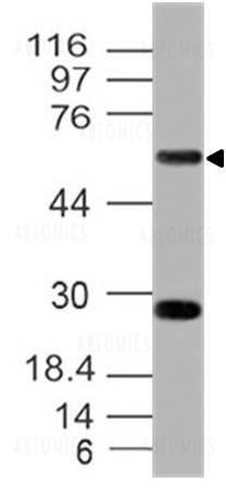Anti-Human CD39 (Clone: ABM41E2)