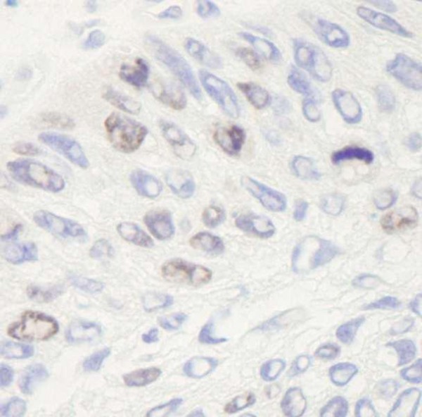 Anti-Topo II Alpha (IHC)