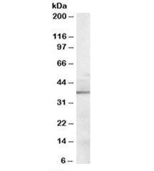 Anti-Sorbitol Dehydrogenase