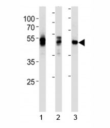 Anti-LCK, clone 845CT3.5.2