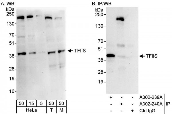 Anti-TFIIS