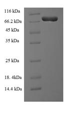 Plastin-2 (LCP1), human, recombinant