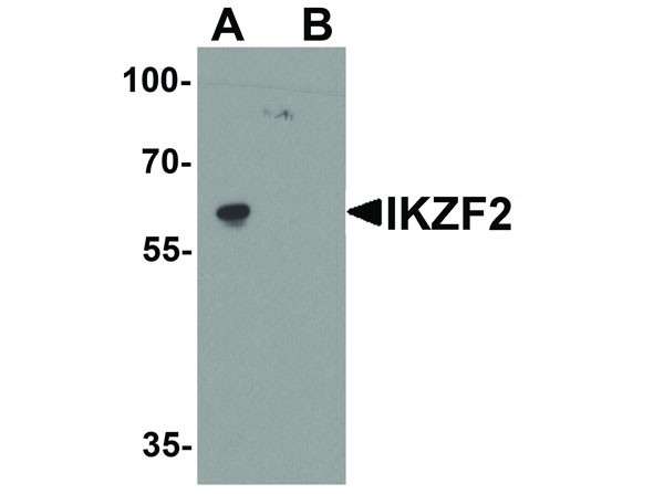 Anti-IKZF2