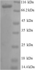 Vitamin K-dependent protein S (PROS1), human, recombinant
