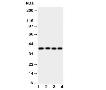 Anti-Bmi1