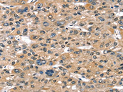 Anti-SULT1B1