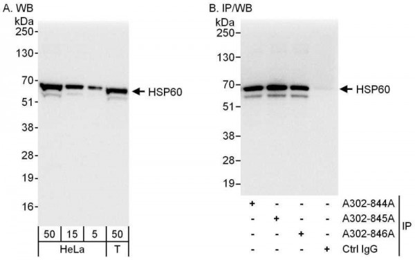 Anti-HSP60