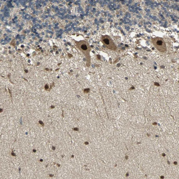 Anti-PSMC4