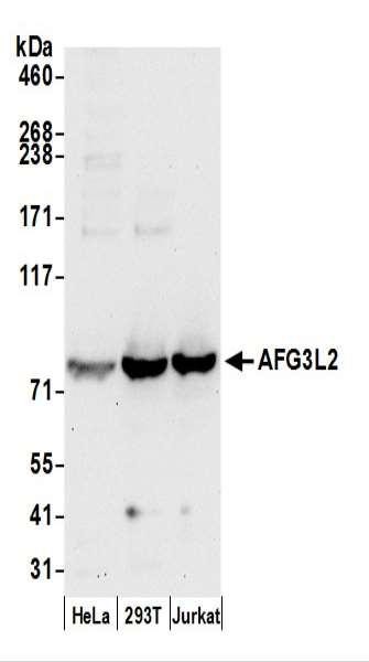 Anti-AFG3L2