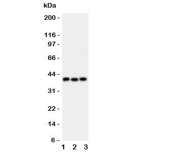 Anti-WNT5A