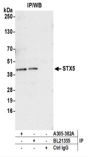 Anti-STX5
