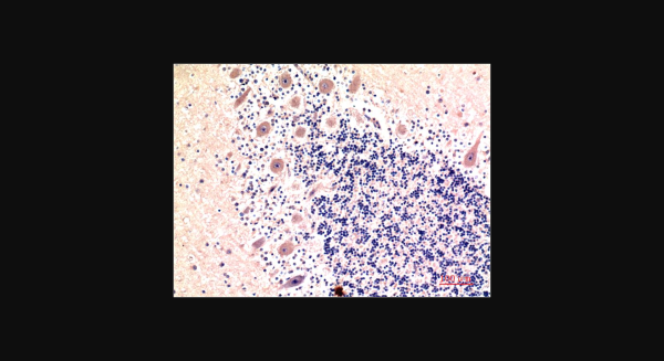 Anti-LC3B (9H5), monoclonal