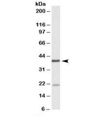Anti-KLHDC8B