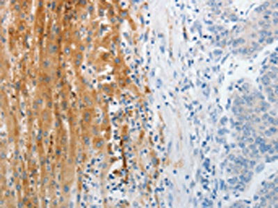 Anti-TRPM1