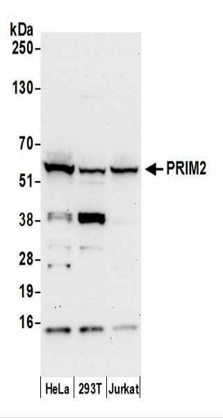 Anti-PRIM2/DNA Primase Large Subunit