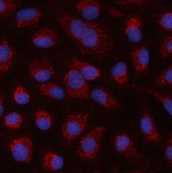 Anti-HSPA4L / Heat shock 70 kDa protein 4L