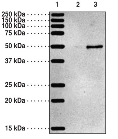 Anti-5-oxoETE receptor