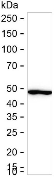 Anti-HADHB (recombinant antibody)