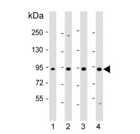 Anti-Ras-interacting protein 1 / RASIP1