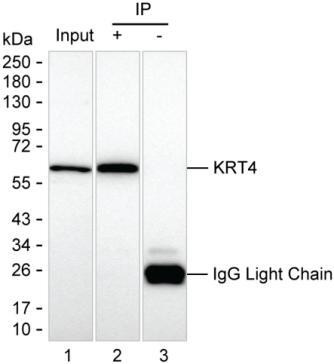 Anti-KRT4
