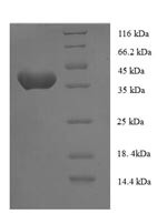 Anaphase-promoting complex subunit 15 (ANAPC15), human, recombinant