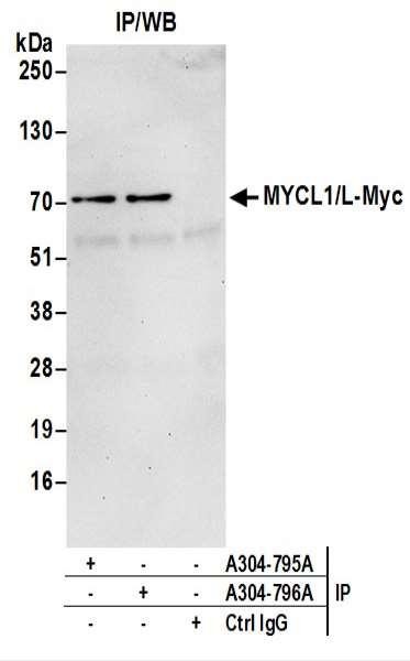Anti-MYCL1/L-Myc