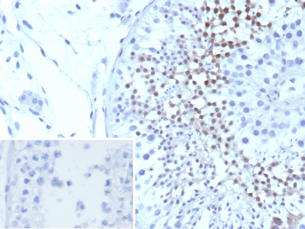 Anti-CETN1 / Centrin-1, clone CETN1/9880