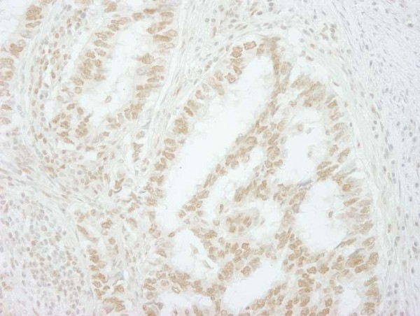 Anti-MKRN2 (IHC)