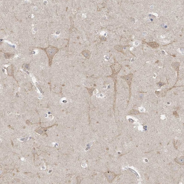 Anti-TSSC1