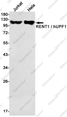 Anti-Recombinant RENT1, clone C213088