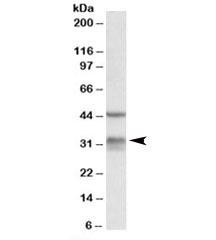 Anti-Hsd11b1