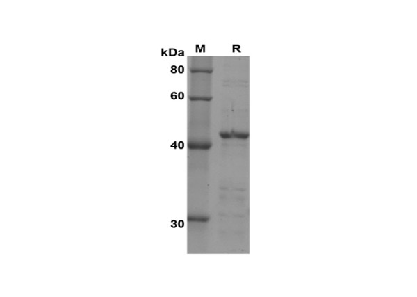 PD-L1 (human), recombinant protein (Sumo Tag)