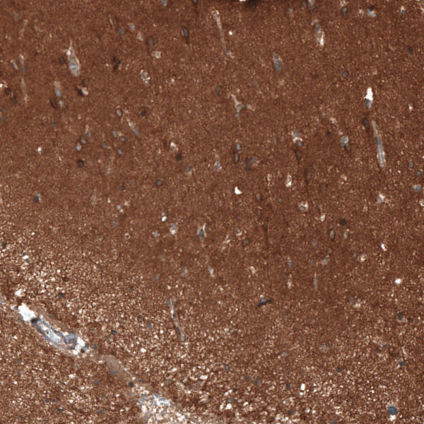 Anti-ATP6AP2