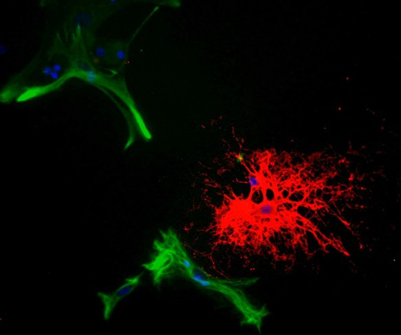 Anti-CNPase