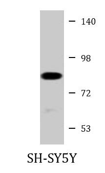 Anti-PKC beta I + II