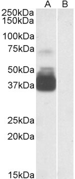 Anti-P2RX7 / P2X7 receptor, N-terminal