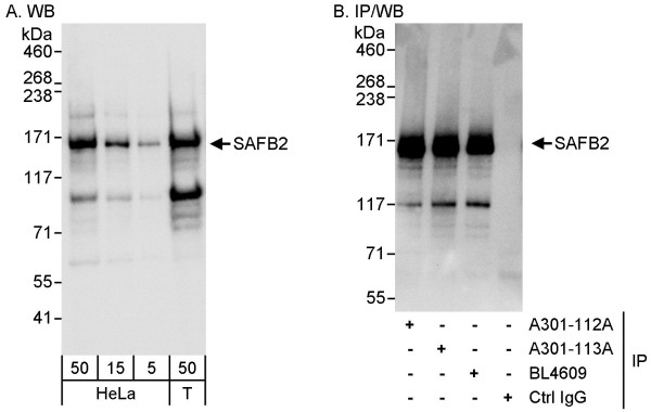 Anti-SAFB2