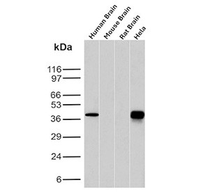 Anti-FOLR1 / Folate receptor 1, clone FOLR1/12903R
