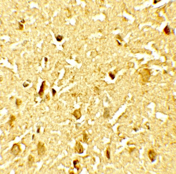 Anti-phospho-SAMHD1 (Thr592)