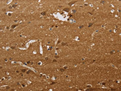 Anti-ELAVL2