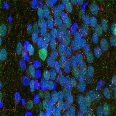 Anti-Adenylate cyclase 3