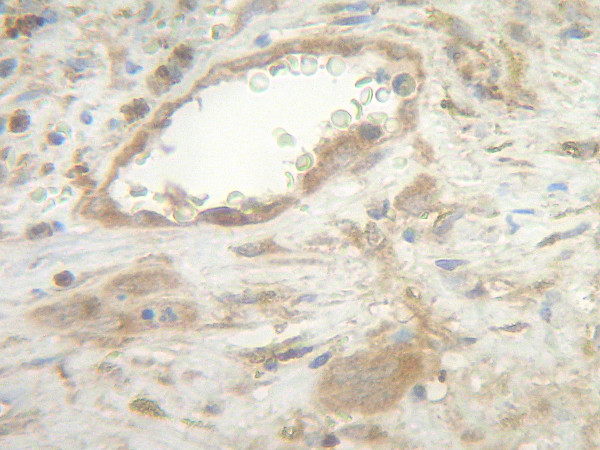 Anti-Fas Ligand