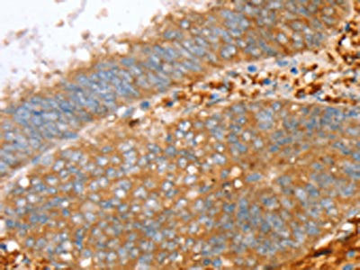 Anti-PTPN7